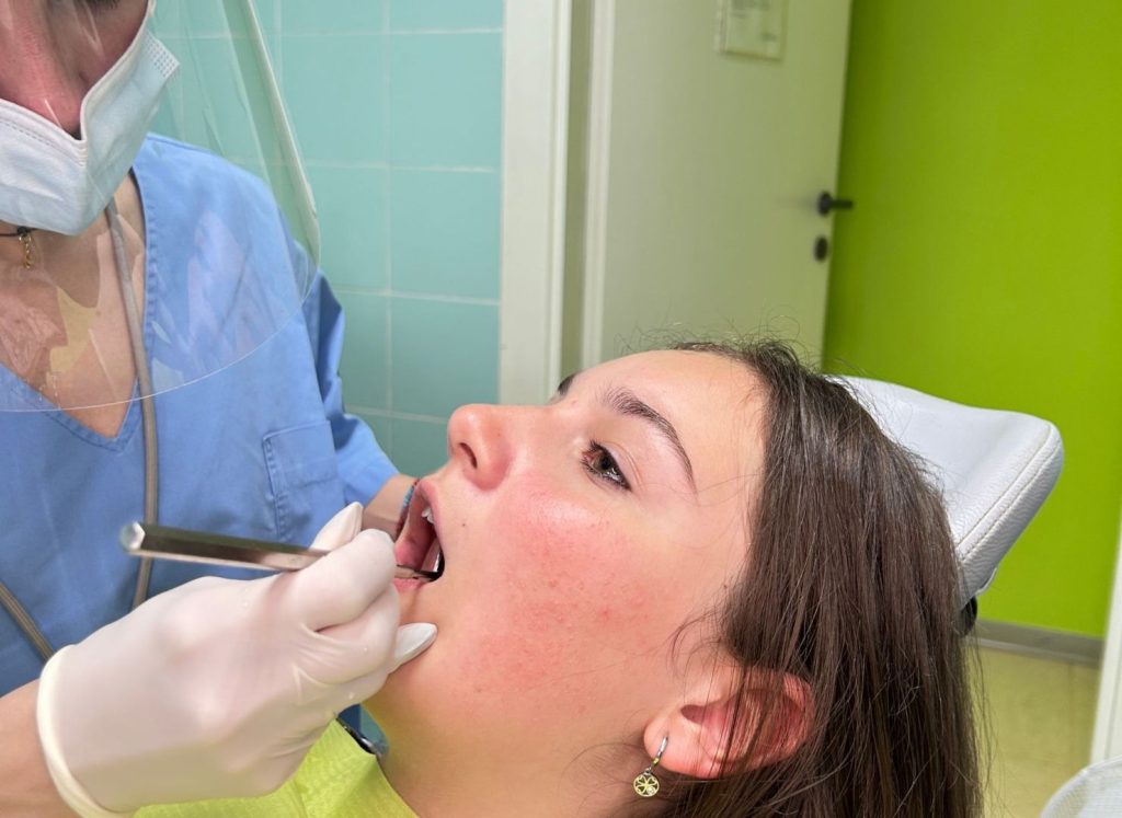 Come avviene la pulizia dei denti dal dentista 1 come avviene la pulizia dei denti dal dentista