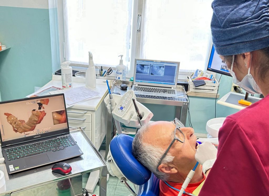 Come si effettua un impianto dentale 2 Come si effettua un impianto dentale